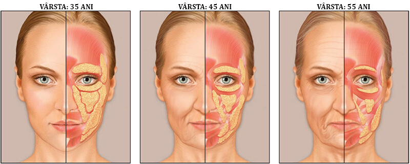 3 varste
